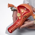 La endometriosis: Una enfermedad silenciosa que muchas mujeres padecen sin saberlo